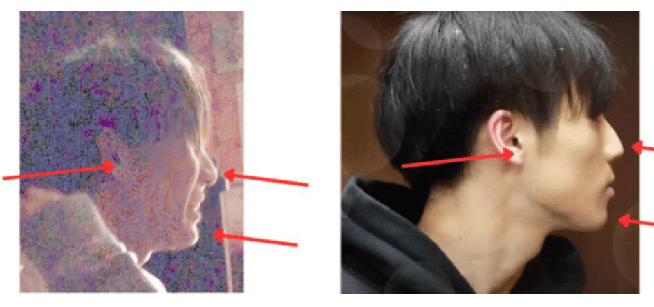 松田元太